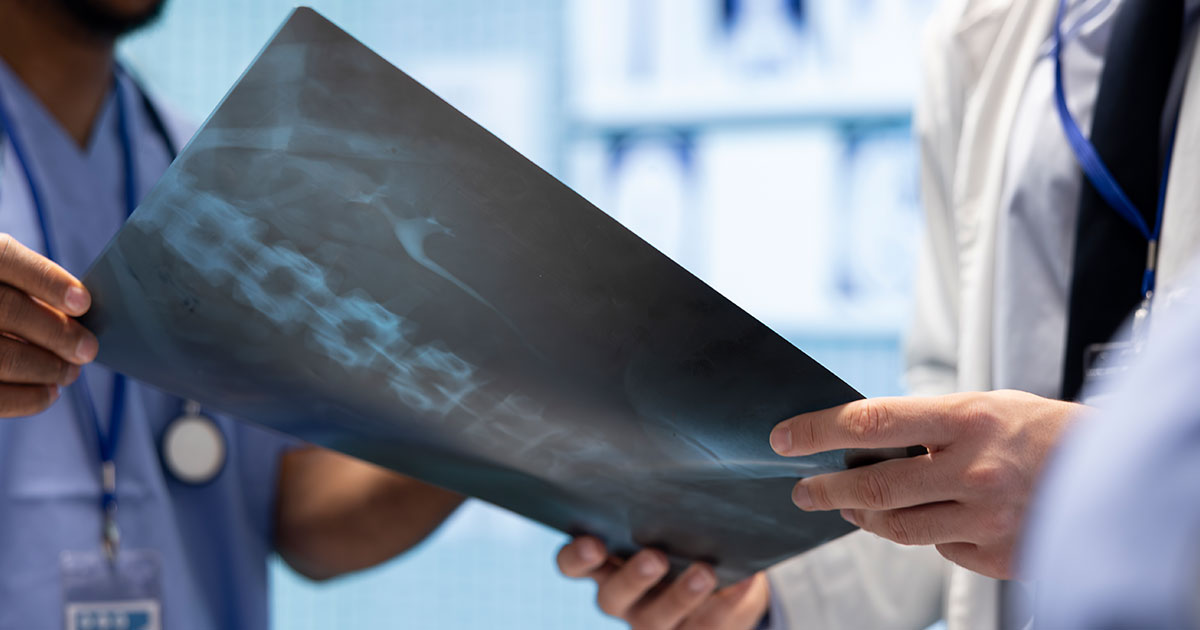 What is Angioembolization? A Basic Guide